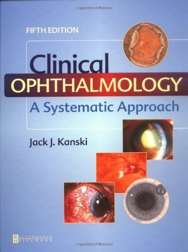 Clinical Ophthalmology: A Systematic Approach