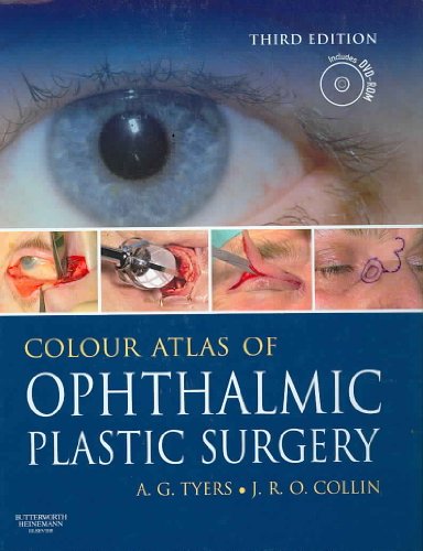 Colour Atlas of Ophthalmic Plastic Surgery with DVD